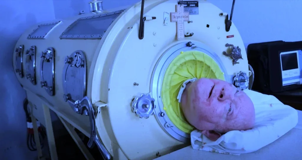 Paul Alexander in Iron Lung